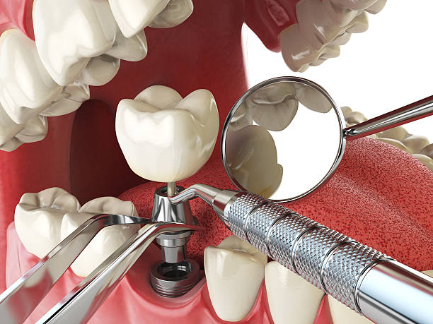 Best Emergency Dental Care for Abscessed Tooth in Galatia, IL