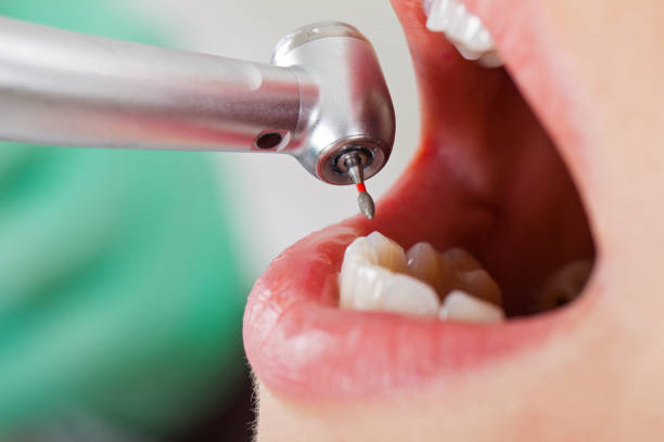 Best Pediatric Emergency Dentist in Galatia, IL